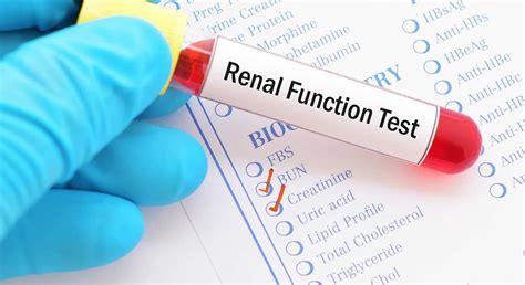 kidney health tests